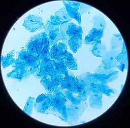 human cheek cell